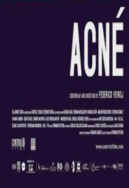 دانلود فیلم Acné 2008